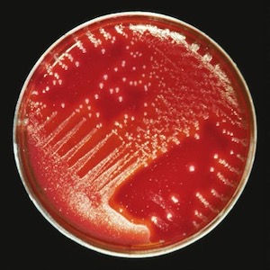 تسبب البكتيريا العقدية من المجموعة (أ) (المسماة بالعقدية أ) عدوى تتراوح في شدتها بين الدرجة الطفيفة والمميتة.