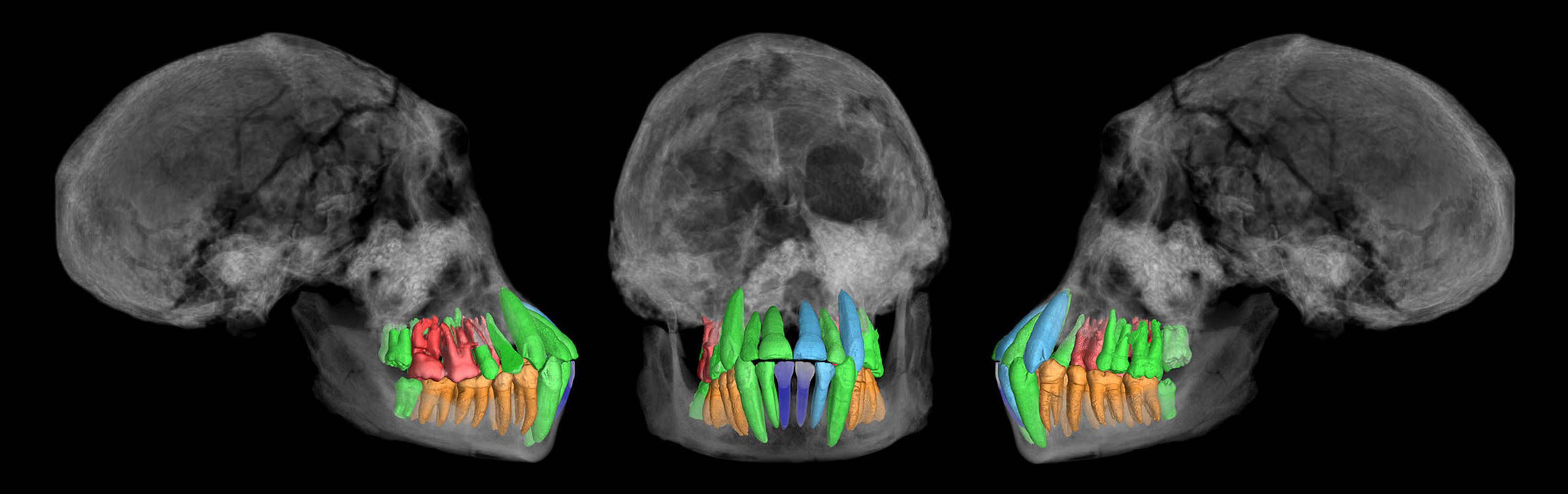 ドマニシで発見された初期のヒト属個体の頭蓋および歯列のCT画像。