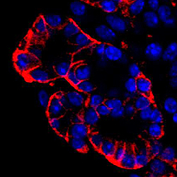 ヒト胚性幹細胞捏造事件