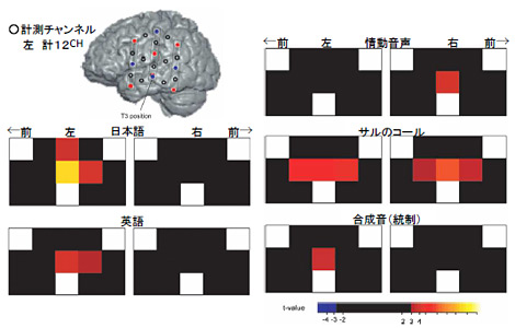 赤ちゃんの言語習得能力を脳機能イメージングで研究 特集記事 Nature Careers Nature Portfolio